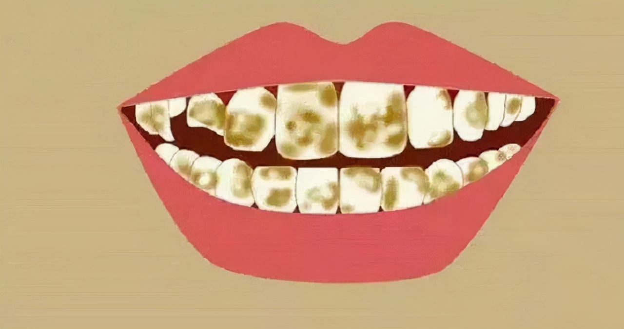 牙越来越黄了，到底该怎么办？