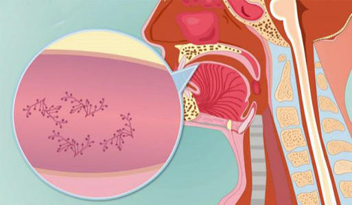 口腔网：如何维护口腔黏膜的健康？