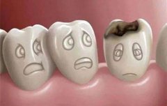 口腔网：龋齿的有效治疗方法？值得收藏
