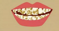 为什么牙齿会发黄？牙齿发黄该怎么办？