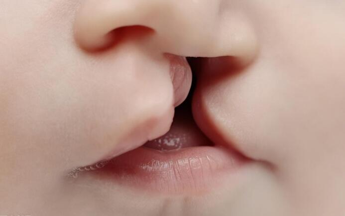 唇腭裂语音矫正训练，口腔发音功能和共鸣问题如何解决？